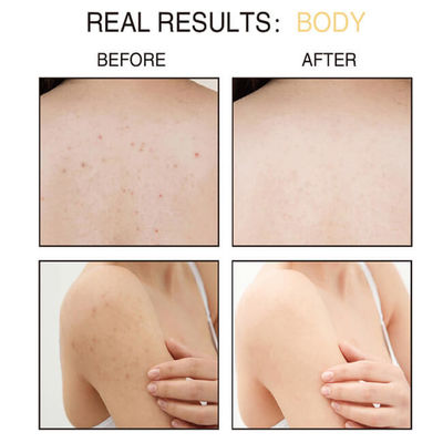 Private Label Organic Exfoliating Body Scrub , Coffee Scrub For Dead Skin